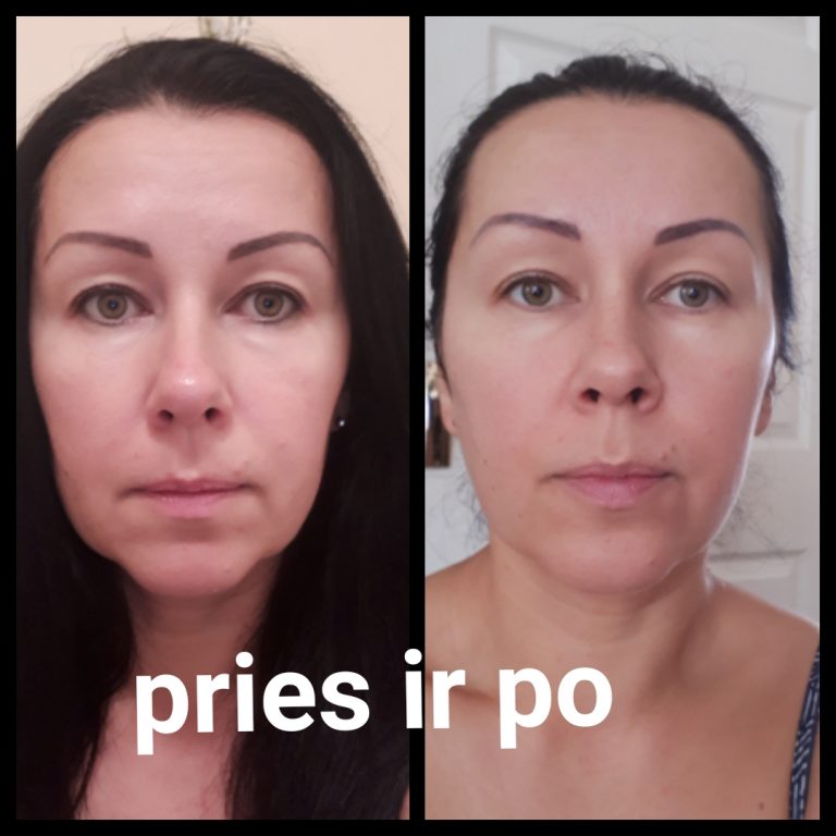 Renata (43 m.) Programos "Startas" dalyvė. Nuotrauka daryta jos pačios. Renata (43 m.) Programos "Startas" dalyvė. Nuotrauka daryta jos pačios.